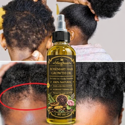 Meghan 2-in-1 Ultimate Hair Growth Duo – Rosemary Oil & Chebe Hair Cream for Stronger, Longer Hair