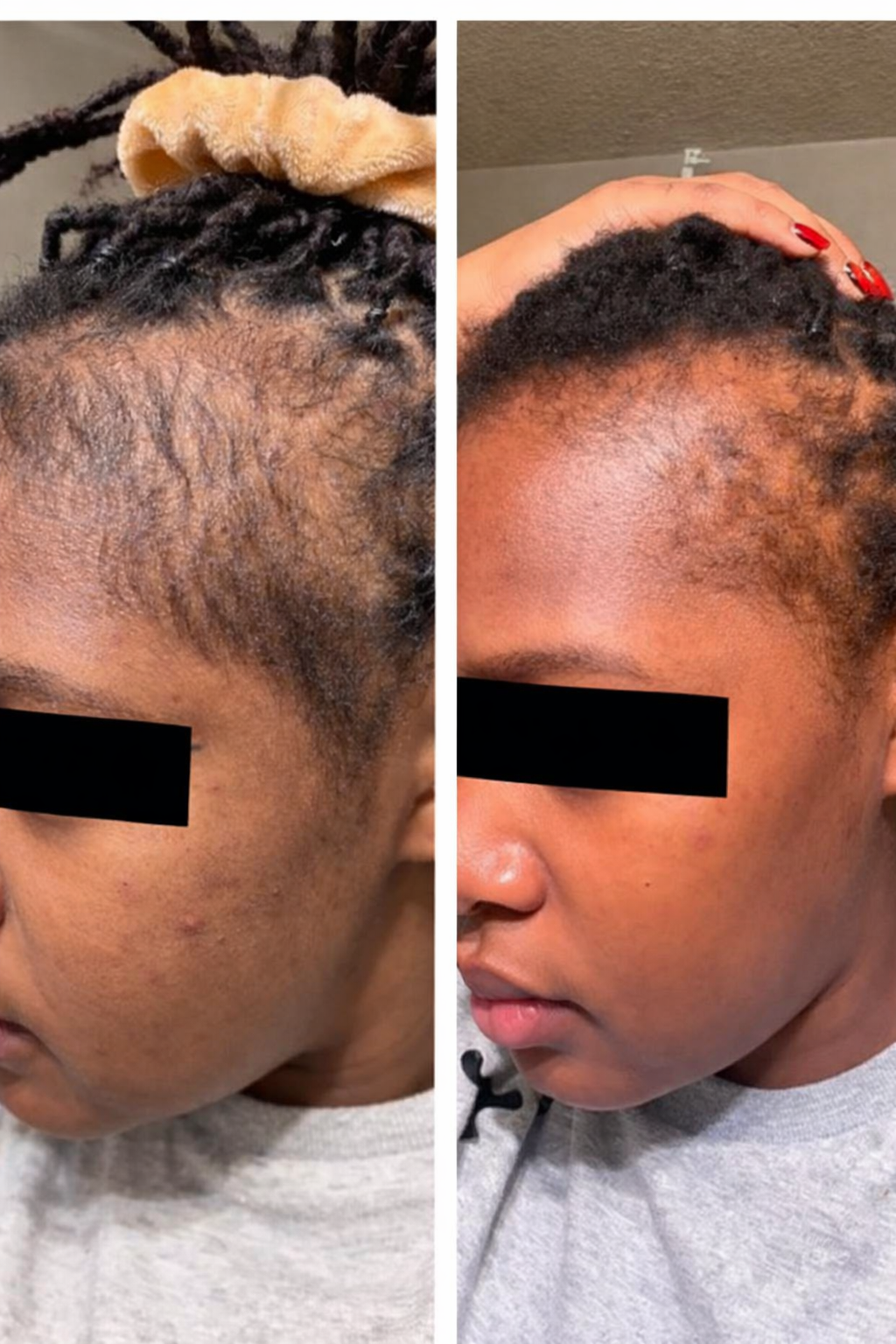 Meghan - Rosemary Hair Growth Oil – Stimulate Stronger, Fuller, Faster-Growing Hair Naturally